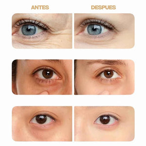 Lumi Eyes Pro LED y EMS - Mimar by Maria